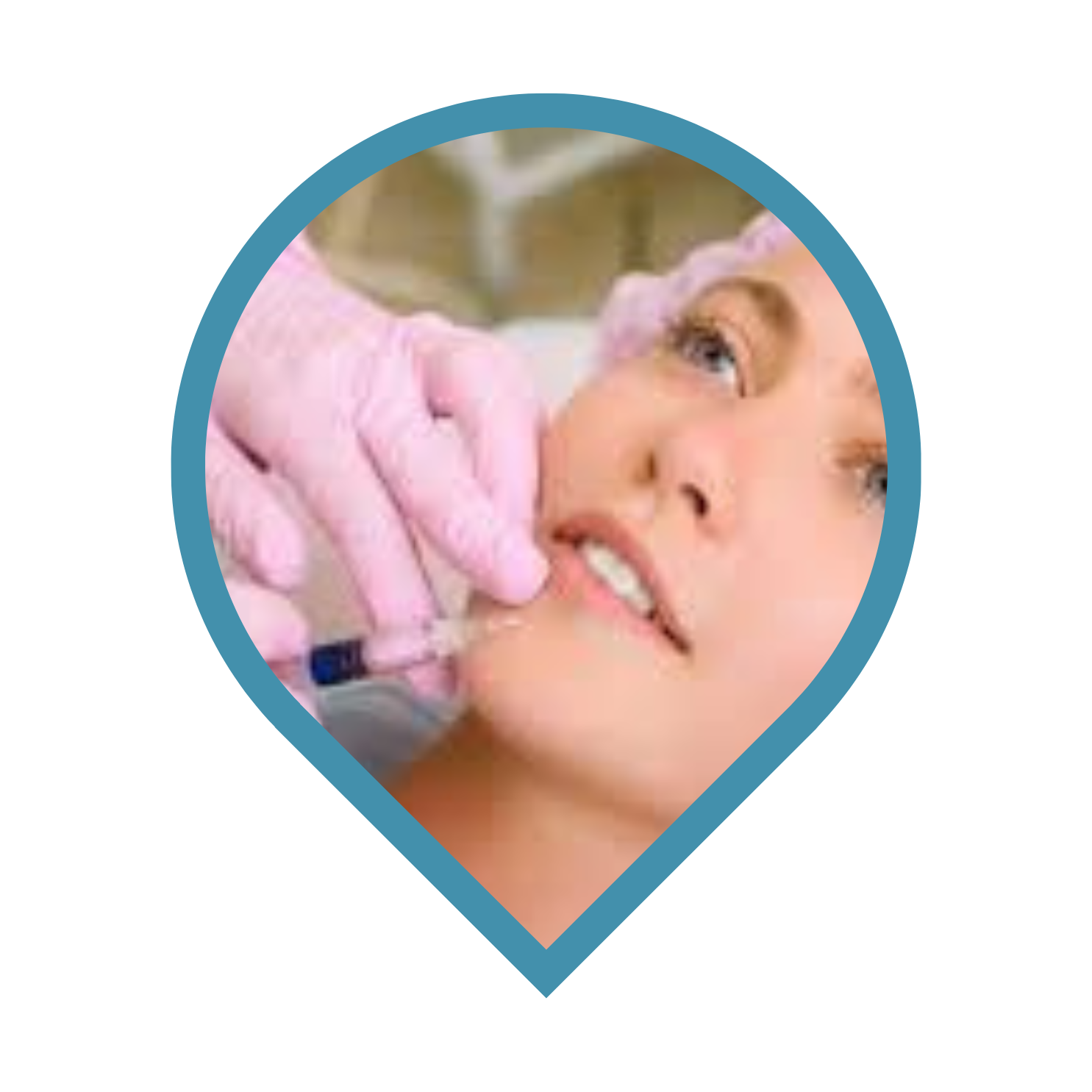 Dermal Fillers