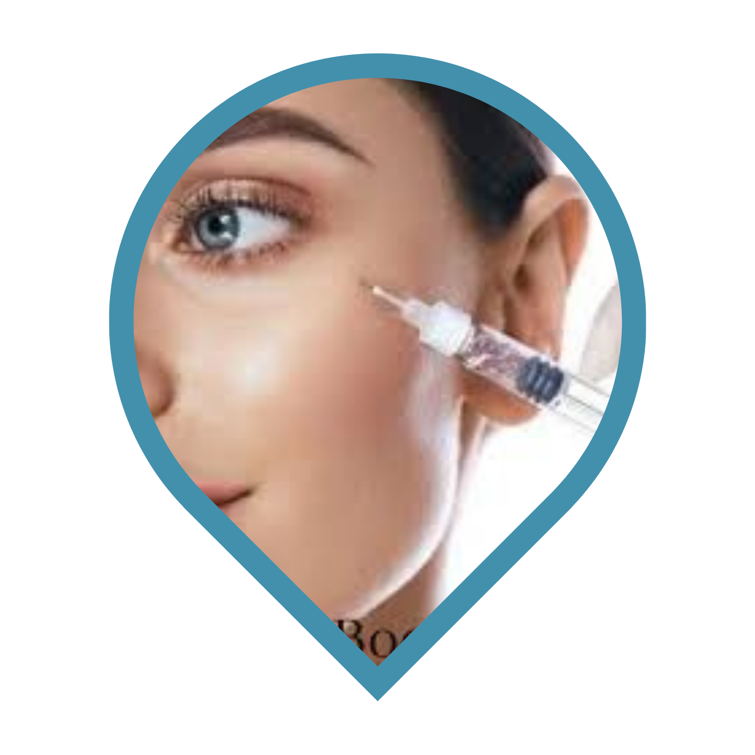 Skin Boosters