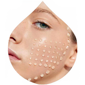 Skin Boosters